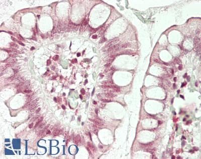 IHC-plus™ ING4 Antibody (aa162-195)