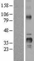 CCND2 / Cyclin D2 Protein (Over-Expression Lysate Myc-DDK (Flag))