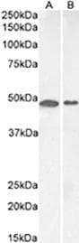 Polyclonal Rabbit anti-Mouse MC3R / MC3 Receptor Antibody (IHC, WB)