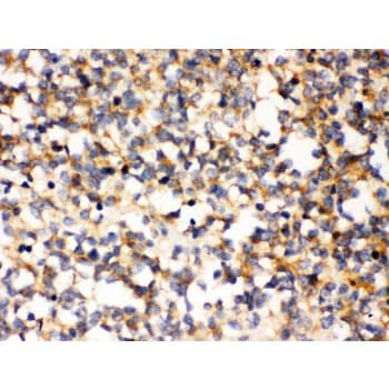 Polyclonal Rabbit anti-Human PAK7/PAK5 Antibody (aa26-55, IHC, WB)
