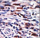 Polyclonal Rabbit anti-Human PRKCH / PKC-Eta Antibody (aa210-239, IHC, WB)
