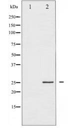 CDKN1A / WAF1 / p21 Antibody