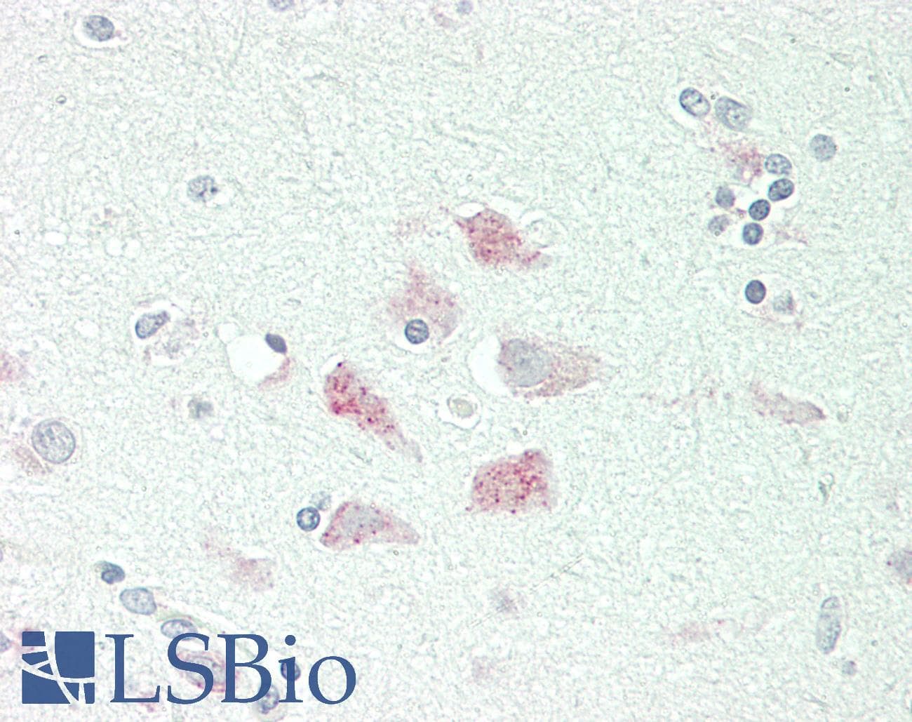 IHC-plus™ DBH/Dopamine Beta Hydroxylase Antibody (aa27-56)