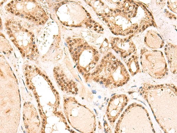RPL13A Antibody