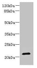 DYDC1 Antibody