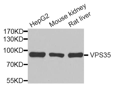 VPS35 Antibody