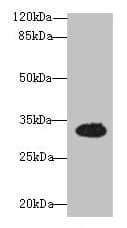 OSER1 / C20orf111 Antibody
