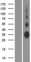 AQP7 / Aquaporin 7 Protein (Over-Expression Lysate Myc-DDK (Flag))