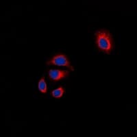 Polyclonal Rabbit anti-Human FAK / Focal Adhesion Kinase Antibody (C-Terminus, IHC, IF, WB)