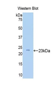 Zyxin Antibody (aa384-572, HRP)