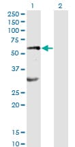 EPOR / EPO Receptor Antibody (clone 3D10)