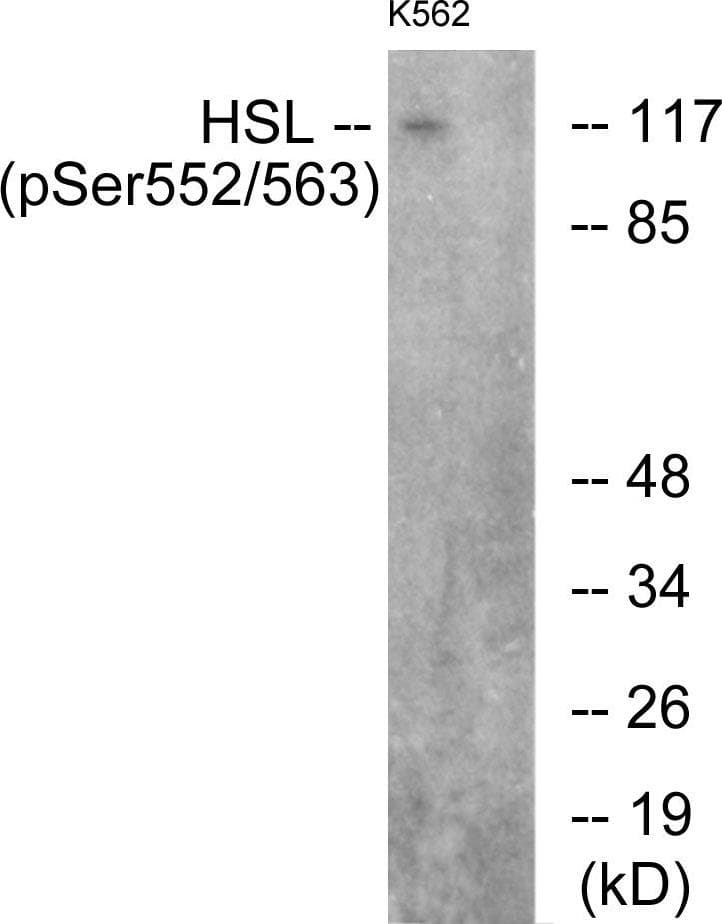 LIPE / HSL Antibody (phospho-Ser552)