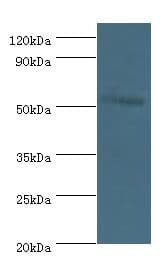 MEF2C Antibody (aa170-380)