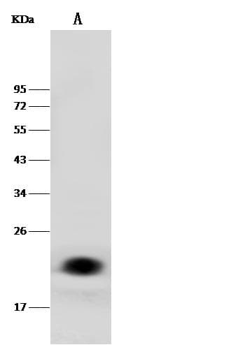 Polyclonal Rabbit anti-Human LCN2 / Lipocalin 2 / NGAL Antibody (Preservative Free, WB)