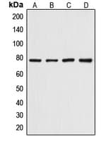 DCLRE1C / Artemis Antibody (phospho-Ser516)