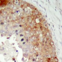 LRRC41 Antibody (Internal)