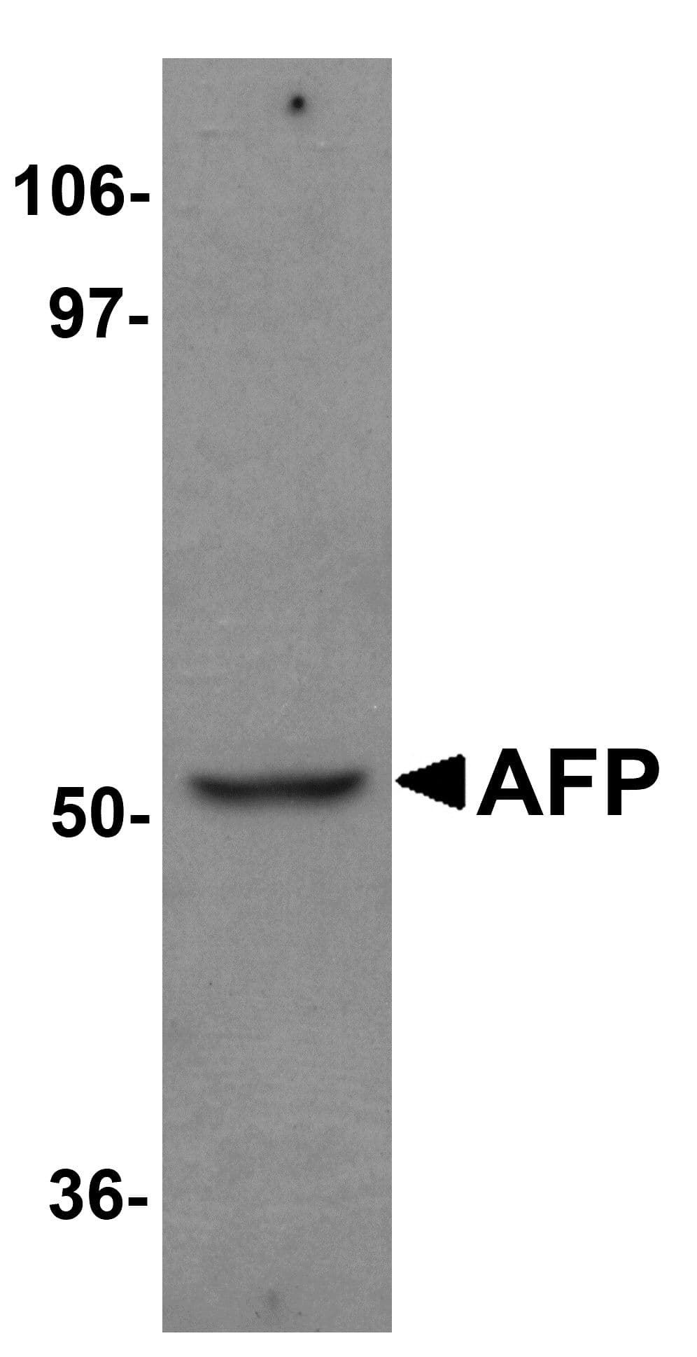 Polyclonal Rabbit anti-Human Alpha-Fetoprotein Antibody (IHC, IF, WB)