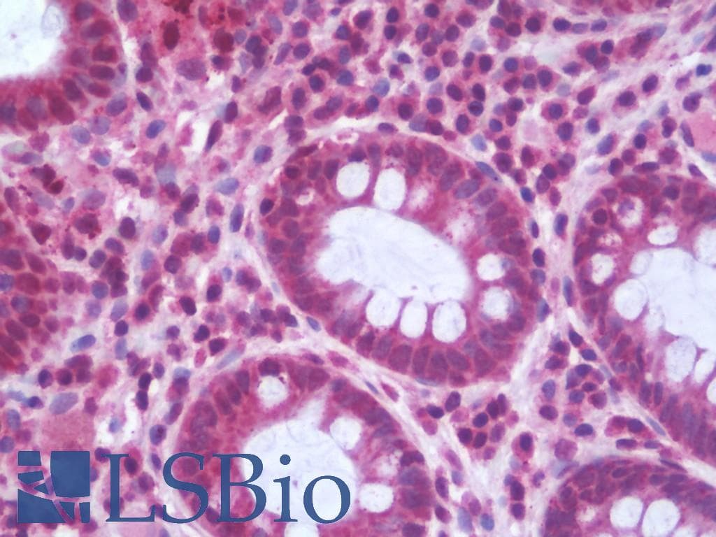 IHC-plus™ Polyclonal Rabbit anti-Human PPP2R5D Antibody (aa544-593, IHC, WB)