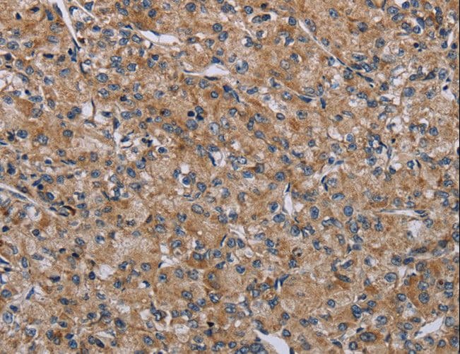 Polyclonal Rabbit anti-Human NALP4 / NLRP4 Antibody (IHC)