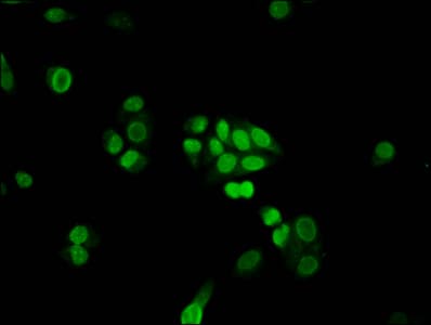 FANCB / FAB Antibody