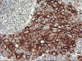 FCGR1A / CD64 Antibody (clone 3D3, Carrier-free)