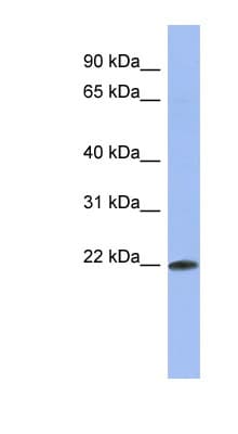 RBM38 Antibody (C-Terminus)
