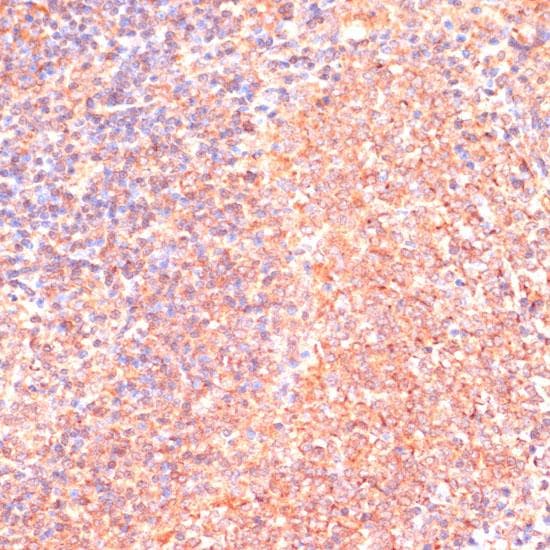 IL4R / CD124 Antibody