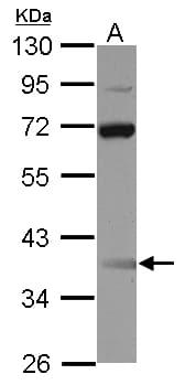 Polyclonal Rabbit anti-Human SSDP1 / SSBP3 Antibody (WB)