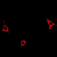 Polyclonal Rabbit anti-Human ASNS Antibody (IF, WB)