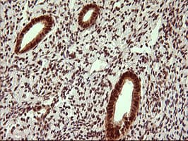 UPRT Antibody (clone OTI2F2)