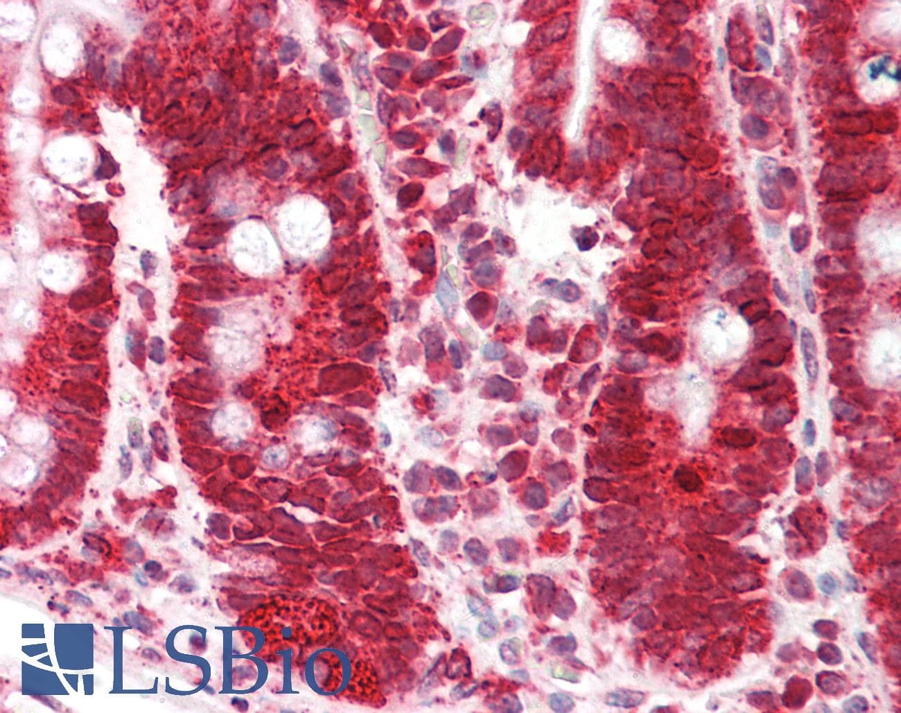 CANX / Calnexin Antibody (aa251-300)