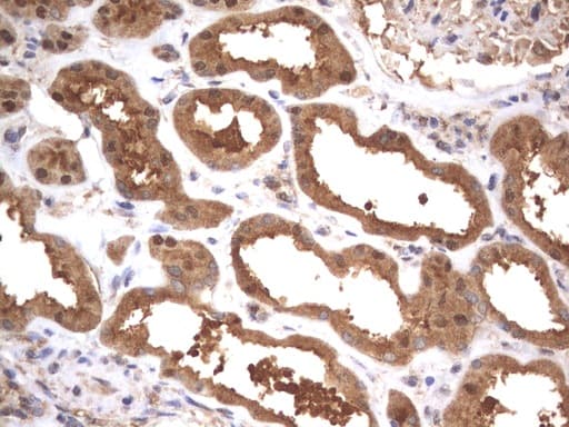 HMBS / PBGD Antibody (clone UMAB144)