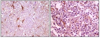 CIB1 / KIP Antibody (clone 5A1F5E12, 5A1H7E12)