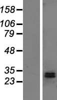 DHRS2 / HEP27 Protein (Over-Expression Lysate Myc-DDK (Flag))
