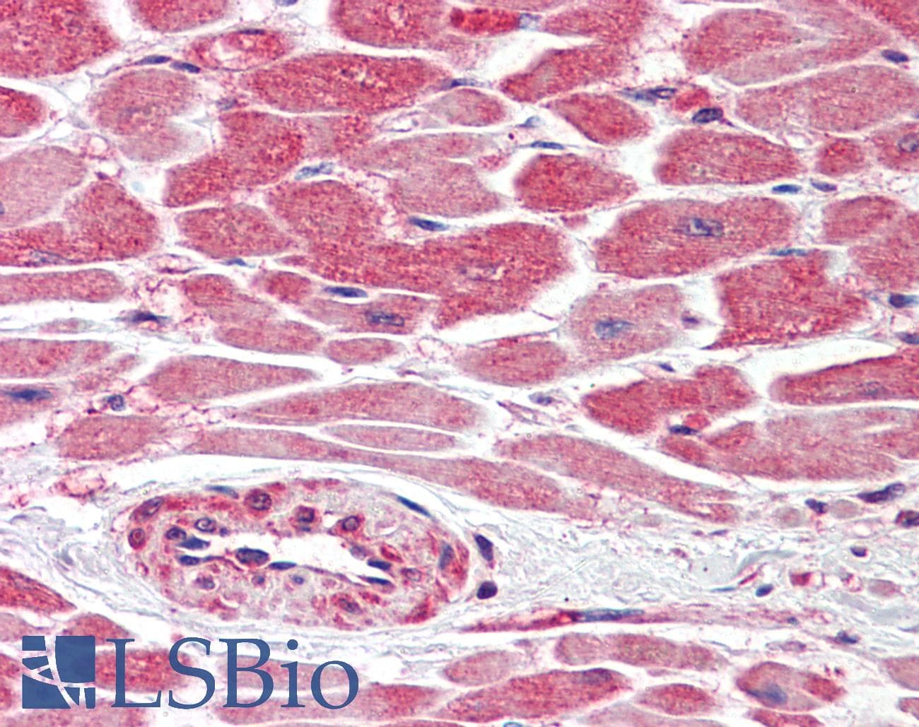IHC-plus™ BMPR2 Antibody (clone 1F12)