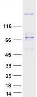 Human MYH3 Protein (Recombinant Myc-DDK (Flag))