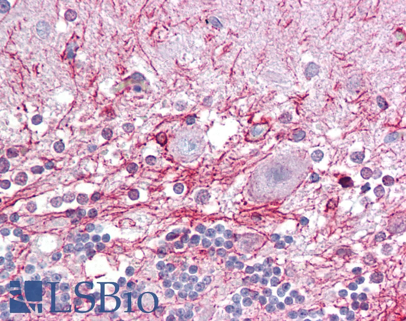 RP2 Antibody (C-Terminus)