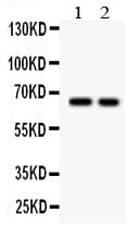 Polyclonal Rabbit anti-Human TGFBR2 Antibody (aa330-346, WB)