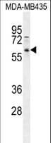 PPP3CC / CALNA3 Antibody (aa10-37)