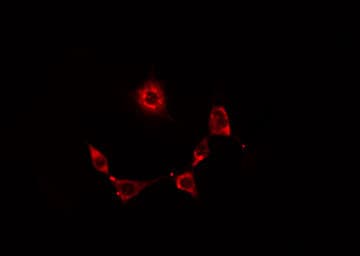 RNF19A / DORFIN Antibody
