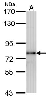 IHC-plus™ LHCGR / LHR / LH Receptor Antibody (aa622-699)