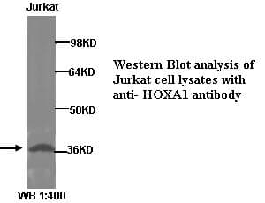 HOXA1 Antibody (Internal)