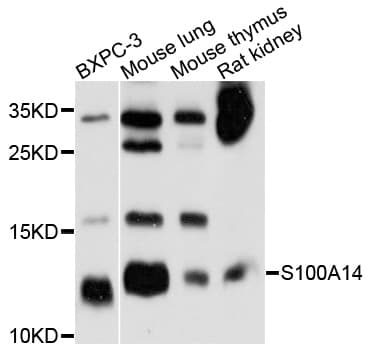 Polyclonal Rabbit anti-Human BCMP84 / S100A14 Antibody (WB)