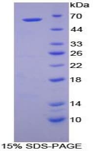 Dog CTSA / Cathepsin A Protein (Recombinant His-GST)