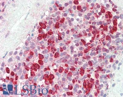 IHC-plus™ CEACAM8 / CD66b Antibody (aa35-320)