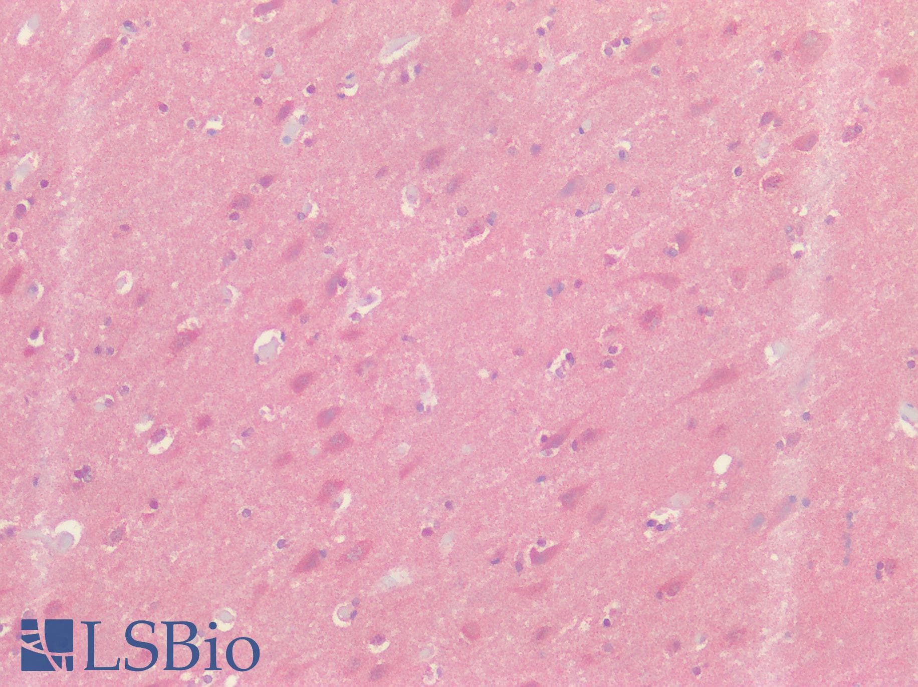 PathPlus™ Polyclonal Rabbit anti-Human T1R3 / TAS1R3 Antibody (N-Terminus, IHC)