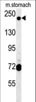 Polyclonal Rabbit anti-Human GCC2 Antibody (aa1581-1609, IHC, WB)