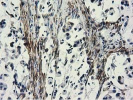 CYB5R3 / B5R Antibody (clone OTI2A10)