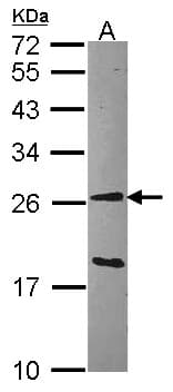 IHC-plus™ Polyclonal Rabbit anti-Human GSTA1 Antibody (IHC, WB)