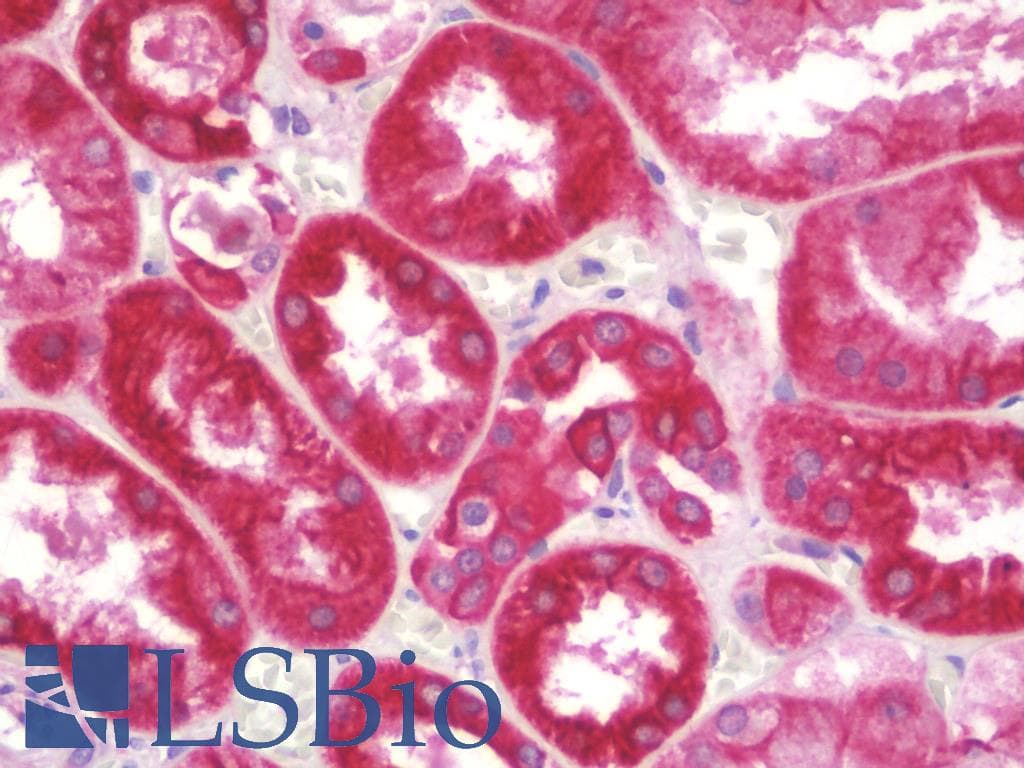 IHC-plus™ Polyclonal Rabbit anti-Human HSD3B7 Antibody (aa121-170, IHC, WB)